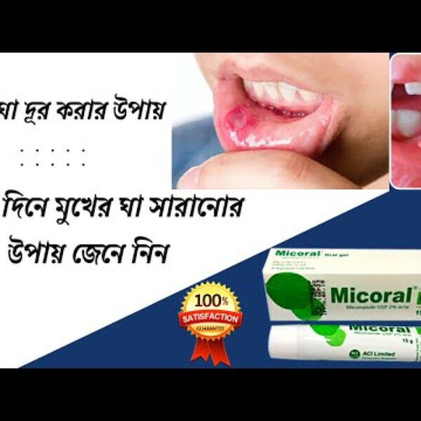 Micoral gel - Image 1